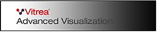 Vitrea® Advanced Visualization