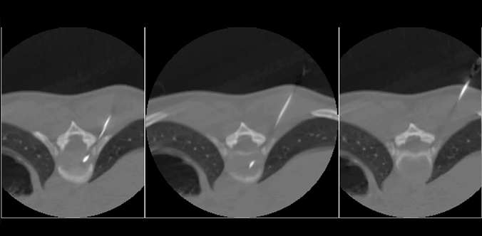 Real-Time Multi-Slice CT